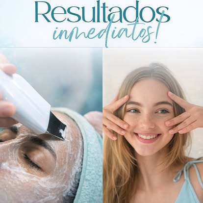 Resultados inmediatos en tratamientos faciales en Aziza Estética Cuenca